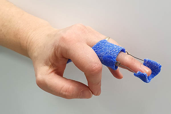 Kleinert-Schiene Daumen/Finger (Capener Splint)